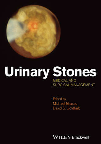 Grasso Michael. Urinary Stones. Medical and Surgical Management
