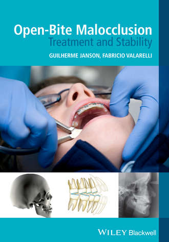 Valarelli Fabricio. Open-Bite Malocclusion. Treatment and Stability