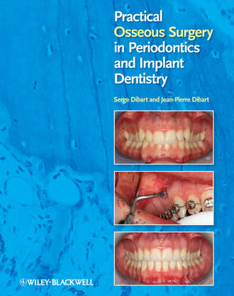Dibart Jean-Pierre. Practical Osseous Surgery in Periodontics and Implant Dentistry