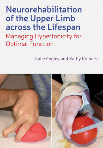 Copley Jodie. Neurorehabilitation of the Upper Limb Across the Lifespan. Managing Hypertonicity for Optimal Function