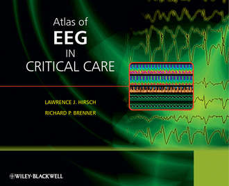 Brenner Richard. Atlas of EEG in Critical Care