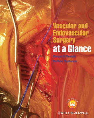Stephenson Matthew. Vascular and Endovascular Surgery at a Glance