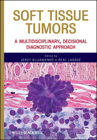 Klijanienko Jerzy. Soft Tissue Tumors. A Multidisciplinary, Decisional Diagnostic Approach