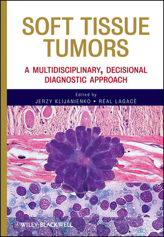Soft Tissue Tumors. A Multidisciplinary, Decisional Diagnostic Approach. Klijanienko Jerzy