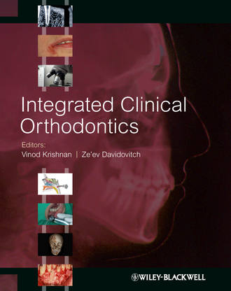 Integrated Clinical Orthodontics. Krishnan Vinod