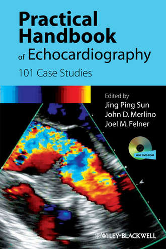 Группа авторов. Practical Handbook of Echocardiography