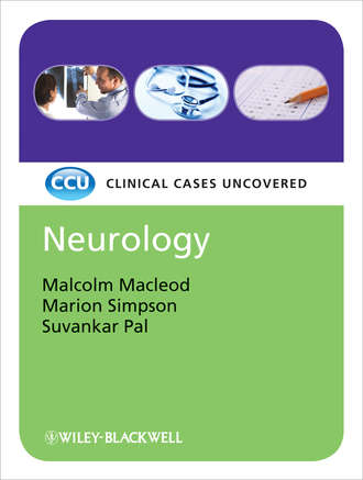 Malcolm Macleod. Neurology