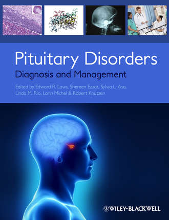 Группа авторов. Pituitary Disorders