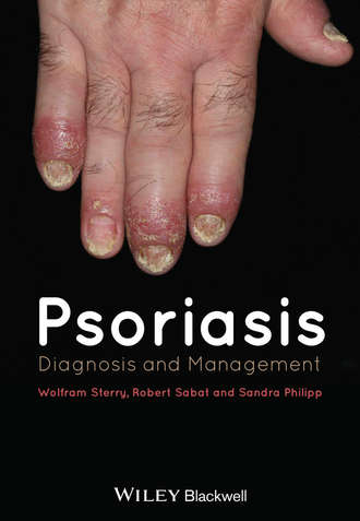 Psoriasis. Группа авторов