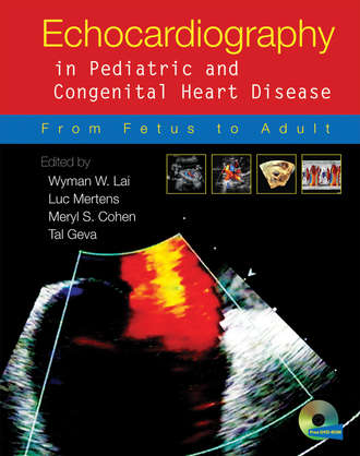 Группа авторов. Echocardiography in Pediatric and Congenital Heart Disease