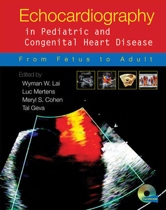 Echocardiography in Pediatric and Congenital Heart Disease. Группа авторов