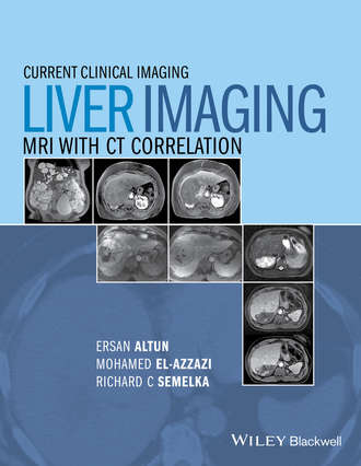 Liver Imaging. Группа авторов
