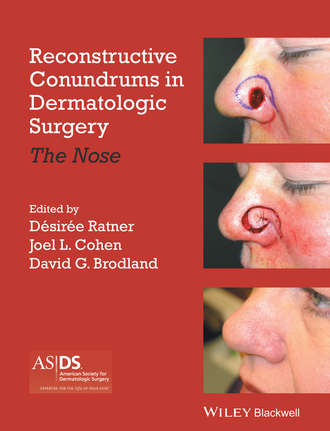 Reconstructive Conundrums in Dermatologic Surgery. Группа авторов