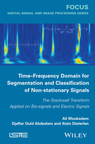 Ali Moukadem. Time-Frequency Domain for Segmentation and Classification of Non-stationary Signals