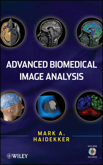 Mark  Haidekker. Advanced Biomedical Image Analysis