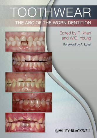 Toothwear. Группа авторов