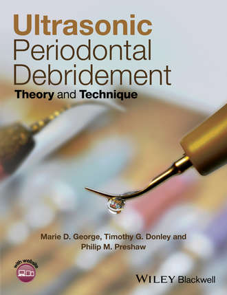 Ultrasonic Periodontal Debridement. Philip M. Preshaw