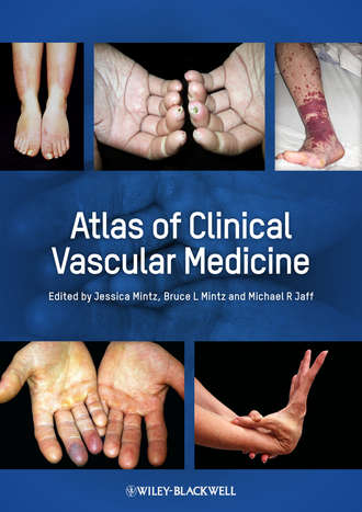 Группа авторов. Atlas of Clinical Vascular Medicine