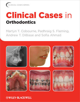 Clinical Cases in Orthodontics. Martyn T. Cobourne