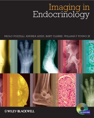 Paolo Pozzilli. Imaging in Endocrinology