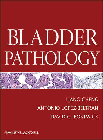 Liang  Cheng. Bladder Pathology