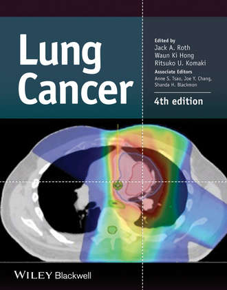 Группа авторов. Lung Cancer