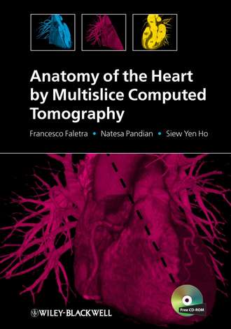 Anatomy of the Heart by Multislice Computed Tomography. Francesco Faletra