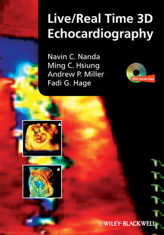 Andrew P. Miller. Live/Real Time 3D Echocardiography