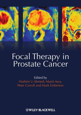 Группа авторов. Focal Therapy in Prostate Cancer