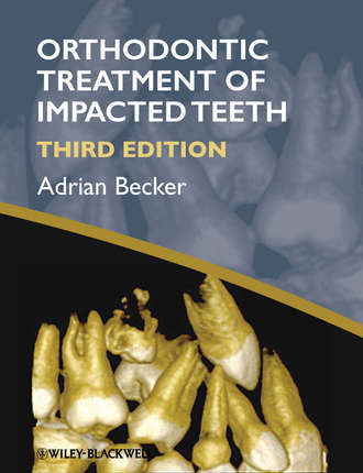Adrian  Becker. Orthodontic Treatment of Impacted Teeth