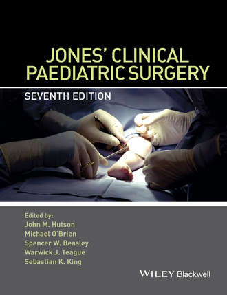Группа авторов. Jones' Clinical Paediatric Surgery
