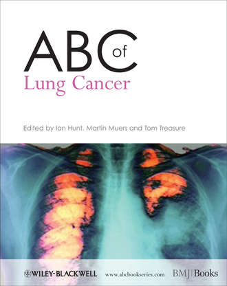 Группа авторов. ABC of Lung Cancer