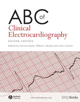 Группа авторов. ABC of Clinical Electrocardiography
