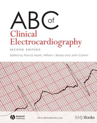 ABC of Clinical Electrocardiography. Группа авторов
