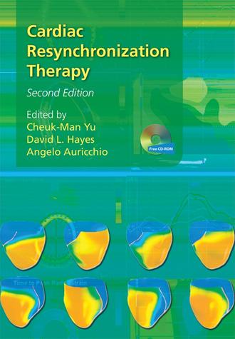 Cardiac Resynchronization Therapy. Группа авторов