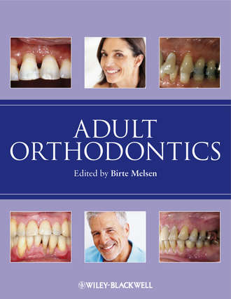 Birte  Melsen. Adult Orthodontics