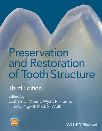 Группа авторов. Preservation and Restoration of Tooth Structure