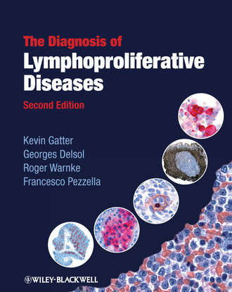Kevin Gatter. The Diagnosis of Lymphoproliferative Diseases