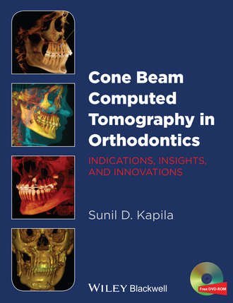 Sunil D. Kapila. Cone Beam Computed Tomography in Orthodontics