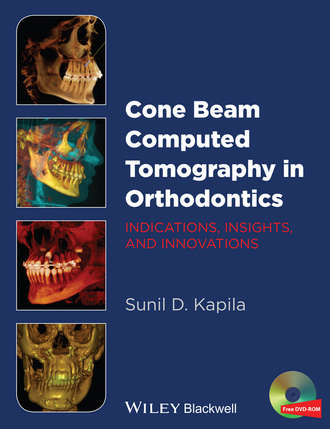 Cone Beam Computed Tomography in Orthodontics. Sunil D. Kapila