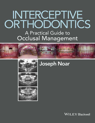 Joseph Noar. Interceptive Orthodontics