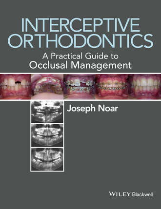 Interceptive Orthodontics. Joseph Noar