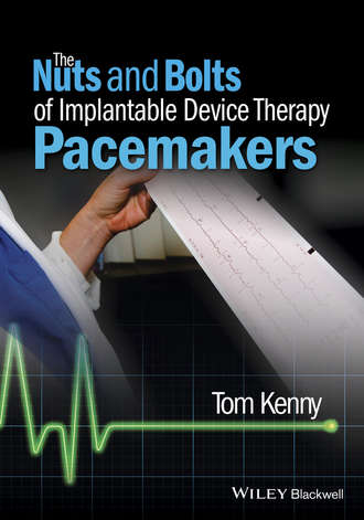 Tom  Kenny. The Nuts and Bolts of Implantable Device Therapy