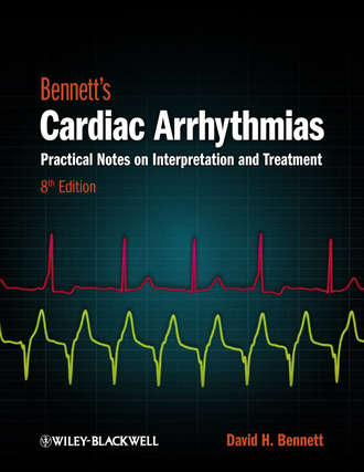 Bennett's Cardiac Arrhythmias. David H. Bennett