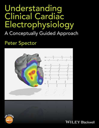 Understanding Clinical Cardiac Electrophysiology. 