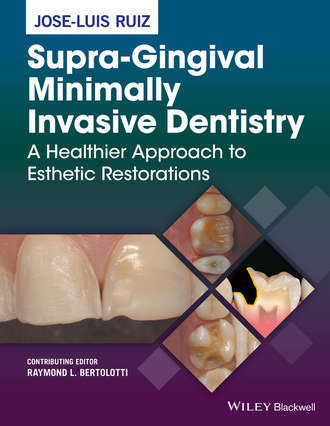 Supra-Gingival Minimally Invasive Dentistry. Jose-Luis Ruiz