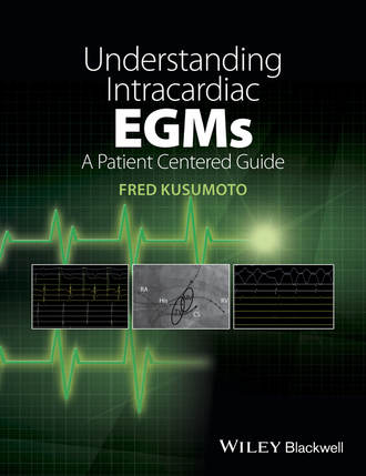 Fred M. Kusumoto. Understanding Intracardiac EGMs