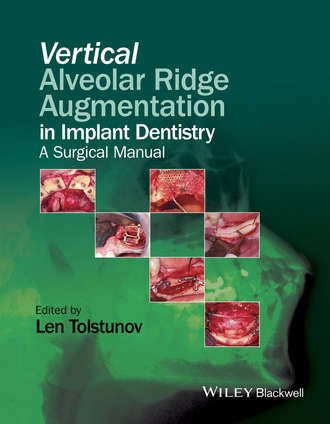 Группа авторов. Vertical Alveolar Ridge Augmentation in Implant Dentistry
