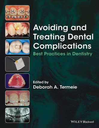 Avoiding and Treating Dental Complications. Группа авторов