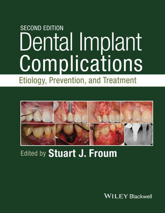Группа авторов. Dental Implant Complications